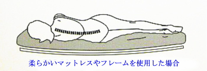 柔らかいマットレスを使った場合 柔らかいマットレスを使った場合